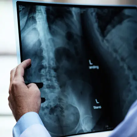 Servicios MataSeguros Daños personales y médicos. Lesiones con secuelas permanentes o persistentes